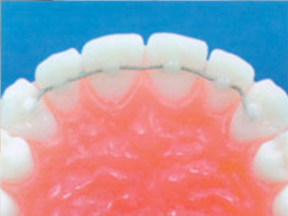 orthodontic parts